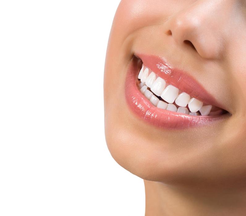 perfect smile wilmette il
