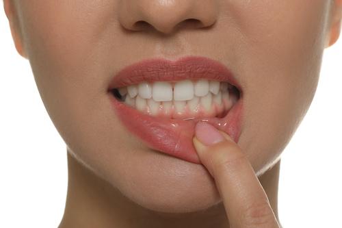 Gum Disease in Wilmette, IL