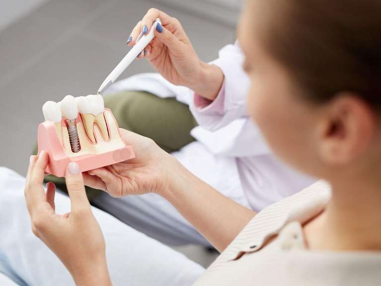 dental implant illustration in wilmette il