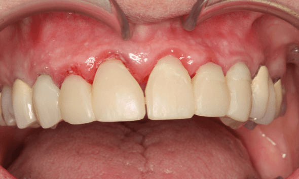 Smile-Makeover-Before-Image