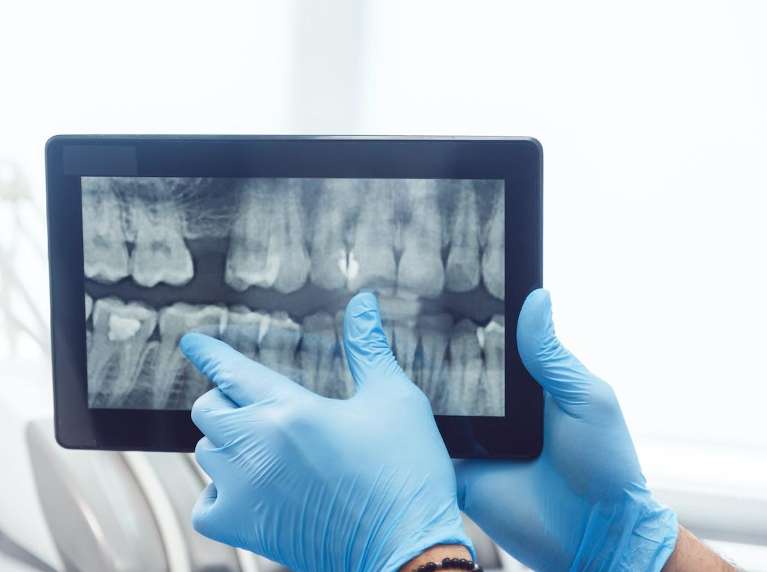 Digital X-Rays in Wilmette, IL